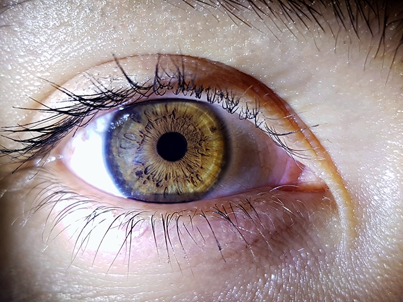 Como saber se descolou a retina?